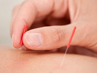 konservative-wirbelsaeulentherapie akupunktur